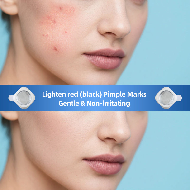 LED Acne Care Patch
