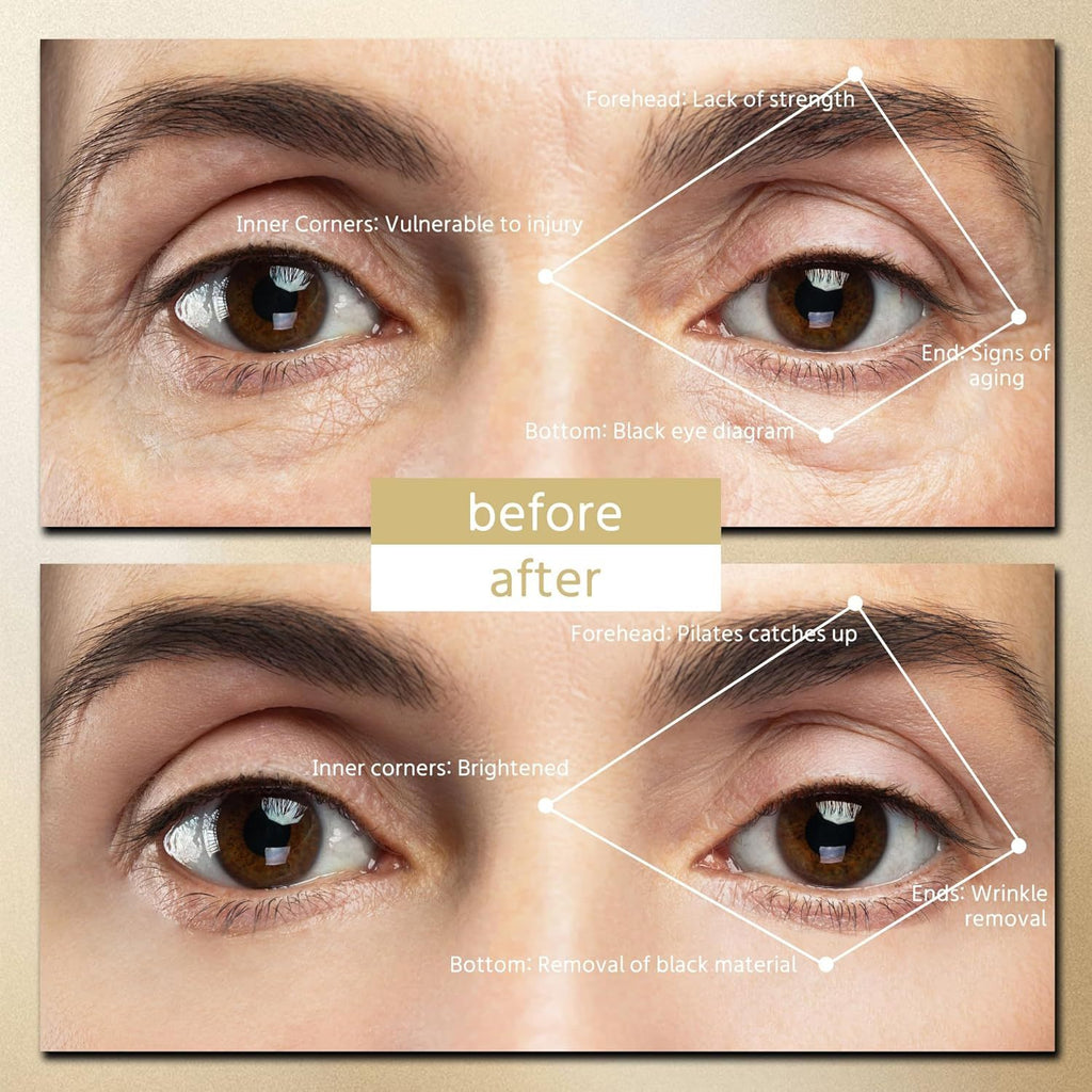 Microcurrent Under-Eye Massager